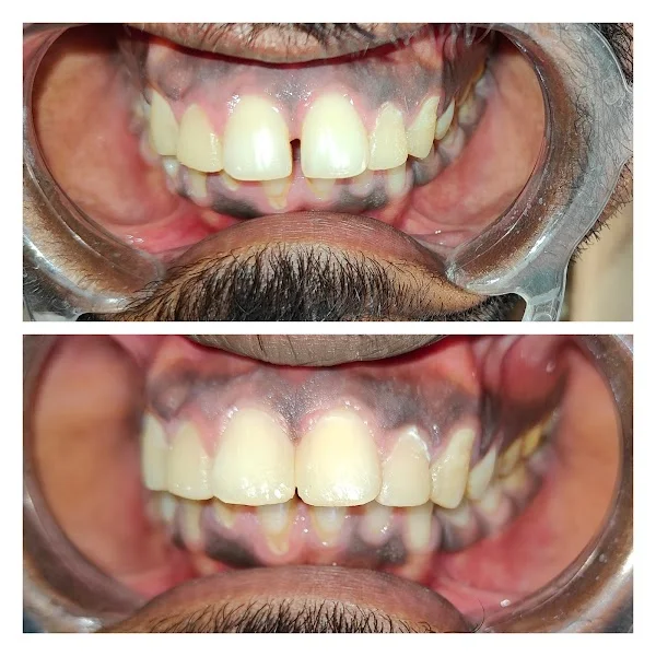 Before & After Case 1