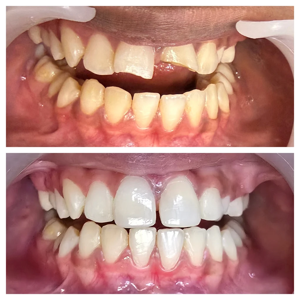 Before & After Case 2